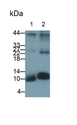 Invitrogen S100A4 Polyclonal Antibody, Invitrogen 20 &mu;L; Unconjugated:Antikroppar