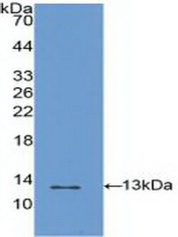 Invitrogen S100A4 Polyclonal Antibody, Invitrogen 20 &mu;L; Unconjugated:Antibodies,