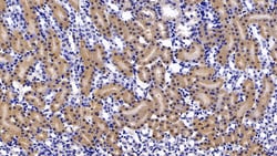 FABP1 Polyclonal Antibody, Invitrogen:Antibodies:Primary Antibodies