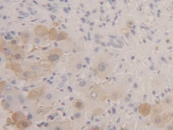 Invitrogen FABP1 Polyclonal Antibody, Invitrogen 20 &mu;L; Unconjugated:Anticuerpos