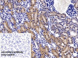 Invitrogen FABP1 Polyclonal Antibody, Invitrogen 20 &mu;L; Unconjugated:Anticuerpos