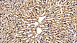 FABP1 Polyclonal Antibody, Invitrogen:Antibodies:Primary Antibodies