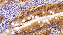 FABP1 Polyclonal Antibody, Invitrogen:Antibodies:Primary Antibodies