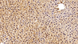 FABP1 Polyclonal Antibody, Invitrogen:Antibodies:Primary Antibodies