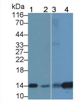 FABP1 Polyclonal Antibody, Invitrogen:Antibodies:Primary Antibodies