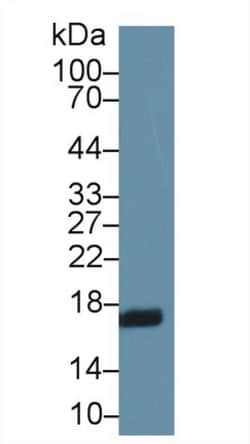 RBP2 Polyclonal Antibody, Invitrogen:Antibodies:Primary Antibodies