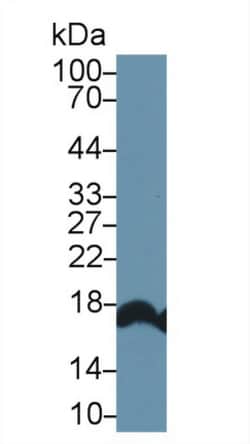 RBP2 Polyclonal Antibody, Invitrogen:Antibodies:Primary Antibodies