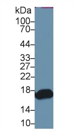 RBP2 Polyclonal Antibody, Invitrogen:Antibodies:Primary Antibodies