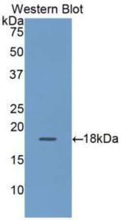 RBP2 Polyclonal Antibody, Invitrogen:Antibodies:Primary Antibodies