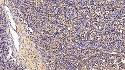 TGF beta-1 Polyclonal Antibody, Invitrogen&trade;