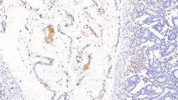 Hemoglobin Polyclonal Antibody, Invitrogen:Antibodies:Primary Antibodies