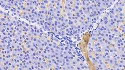 Hemoglobin Polyclonal Antibody, Invitrogen:Antibodies:Primary Antibodies