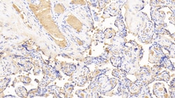 Invitrogen Hemoglobin Polyclonal Antibody, Invitrogen 20 &mu;L; Unconjugated:Antibodies,