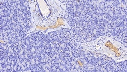 Hemoglobin Polyclonal Antibody, Invitrogen:Antibodies:Primary Antibodies