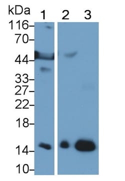 Hemoglobin Polyclonal Antibody, Invitrogen:Antibodies:Primary Antibodies