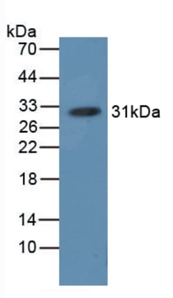 Invitrogen Hemoglobin Polyclonal Antibody, Invitrogen 20 &mu;L; Unconjugated:Antibodies,