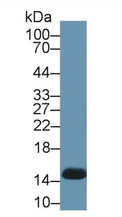 Hemoglobin Polyclonal Antibody, Invitrogen:Antibodies:Primary Antibodies