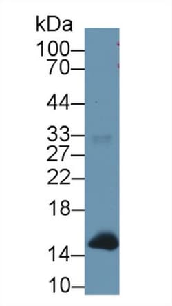 Hemoglobin Polyclonal Antibody, Invitrogen:Antibodies:Primary Antibodies