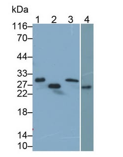 TNNI1 Polyclonal Antibody, Invitrogen:Antibodies:Primary Antibodies