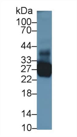 TNNI1 Polyclonal Antibody, Invitrogen:Antibodies:Primary Antibodies