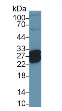 TNNI1 Polyclonal Antibody, Invitrogen:Antibodies:Primary Antibodies