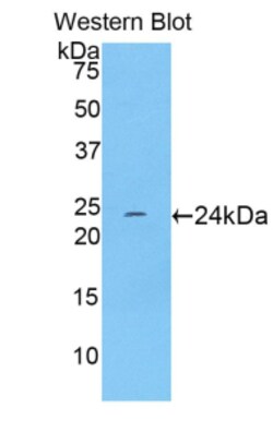 TNNI1 Polyclonal Antibody, Invitrogen:Antibodies:Primary Antibodies