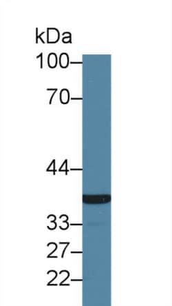Invitrogen GP6 Polyclonal Antibody, Invitrogen:Antibodies:Primary Antibodies