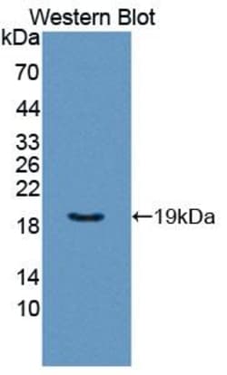 Invitrogen GP6 Polyclonal Antibody, Invitrogen:Antibodies:Primary Antibodies