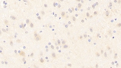 nNOS Polyclonal Antibody, Invitrogen:Antibodies:Primary Antibodies