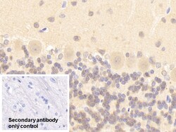 Invitrogen nNOS Polyclonal Antibody, Invitrogen 20 &mu;L; Unconjugated:Antibodies,