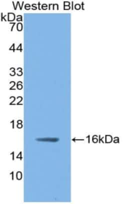nNOS Polyclonal Antibody, Invitrogen:Antibodies:Primary Antibodies