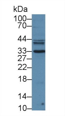 PSA Polyclonal Antibody, Invitrogen:Antibodies:Primary Antibodies