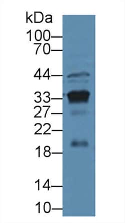 PSA Polyclonal Antibody, Invitrogen:Antibodies:Primary Antibodies