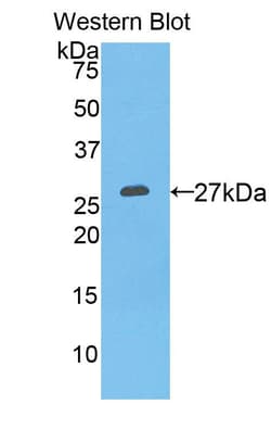 PSA Polyclonal Antibody, Invitrogen:Antibodies:Primary Antibodies