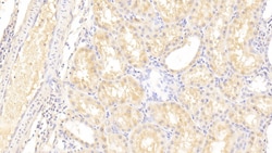 Invitrogen LOXL3 Polyclonal Antibody, Invitrogen 20 &mu;L; Unconjugated:Antibodies,