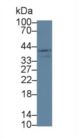 Invitrogen LOXL3 Polyclonal Antibody, Invitrogen 20 &mu;L; Unconjugated:Antibodies,