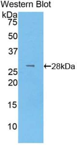 Invitrogen LOXL3 Polyclonal Antibody, Invitrogen 20 &mu;L; Unconjugated:Antibodies,
