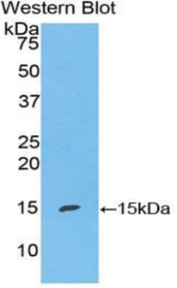 Invitrogen S100A7 Polyclonal Antibody, Invitrogen:Antibodies:Primary Antibodies