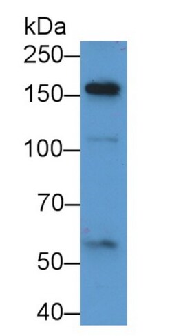 A2ML1 Polyclonal Antibody, Invitrogen:Antibodies:Primary Antibodies