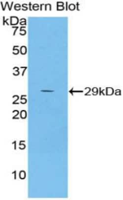 A2ML1 Polyclonal Antibody, Invitrogen:Antibodies:Primary Antibodies