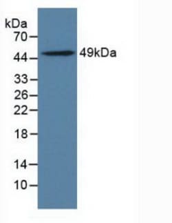Invitrogen LILRB4 Polyclonal Antibody, Invitrogen 20 &mu;L; Unconjugated:Antibodies,