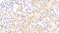 Invitrogen NUP88 Polyclonal Antibody, Invitrogen 200 &mu;L; Unconjugated:Antibodies,