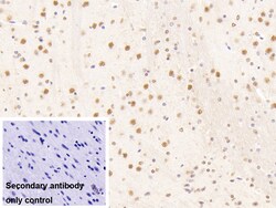 Invitrogen NUP88 Polyclonal Antibody, Invitrogen 200 &mu;L; Unconjugated:Antibodies,