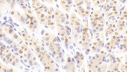 Invitrogen NUP88 Polyclonal Antibody, Invitrogen:Antibodies:Primary Antibodies