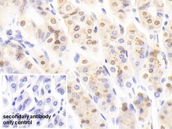 Invitrogen NUP88 Polyclonal Antibody, Invitrogen 200 &mu;L; Unconjugated:Antibodies,