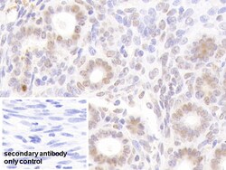 Invitrogen NUP88 Polyclonal Antibody, Invitrogen 200 &mu;L; Unconjugated:Antibodies,