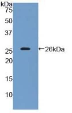 Invitrogen CD200 Polyclonal Antibody, Invitrogen 200 &mu;L; Unconjugated:Antibodies,