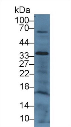 Invitrogen CD200 Polyclonal Antibody, Invitrogen 200 &mu;L; Unconjugated:Antibodies,
