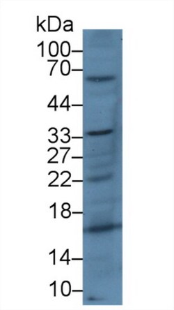 Invitrogen CD200 Polyclonal Antibody, Invitrogen 200 &mu;L; Unconjugated:Antibodies,