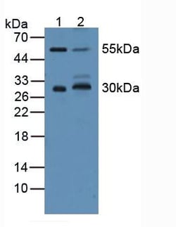 Invitrogen CD200 Polyclonal Antibody, Invitrogen 200 &mu;L; Unconjugated:Antibodies,